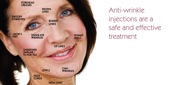 Anti Wrinkle Treatment in Manchester
