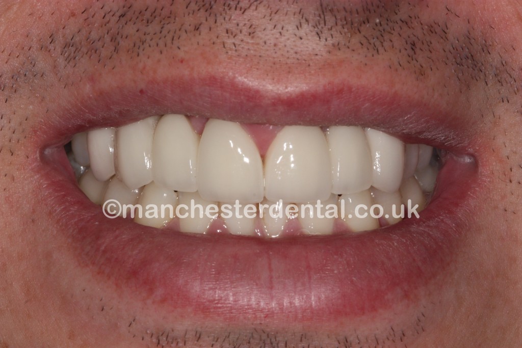 Cosmetic Dentistry Manchester Dental