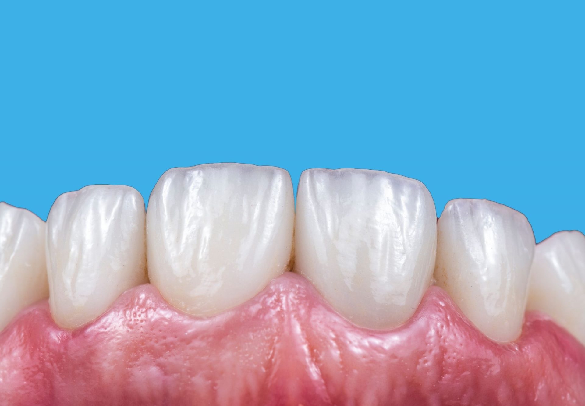 veneers in manchester Manchester Dental