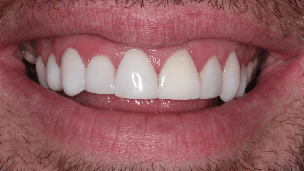 after1 Manchester Dental