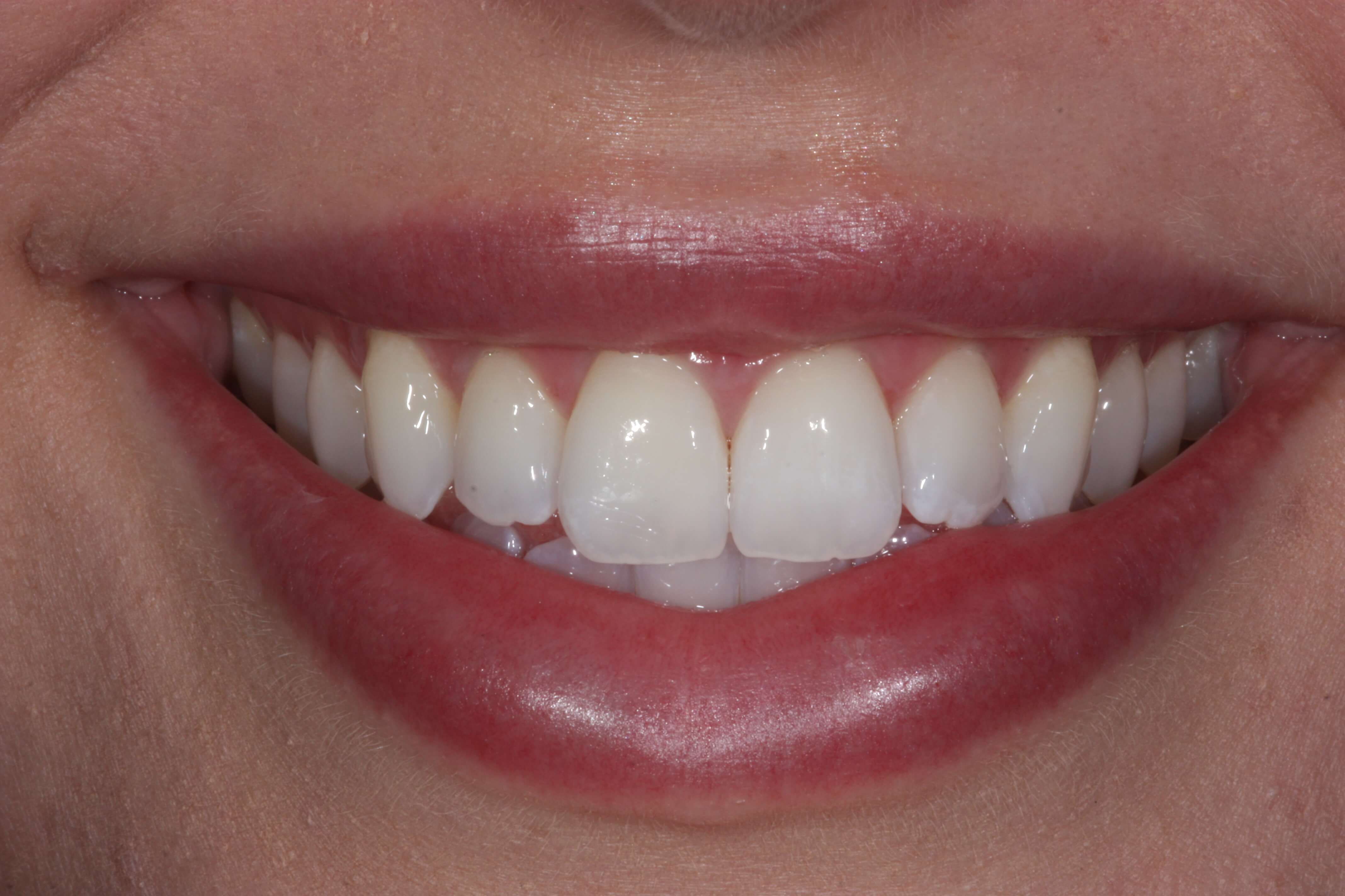 haz1 Manchester Dental