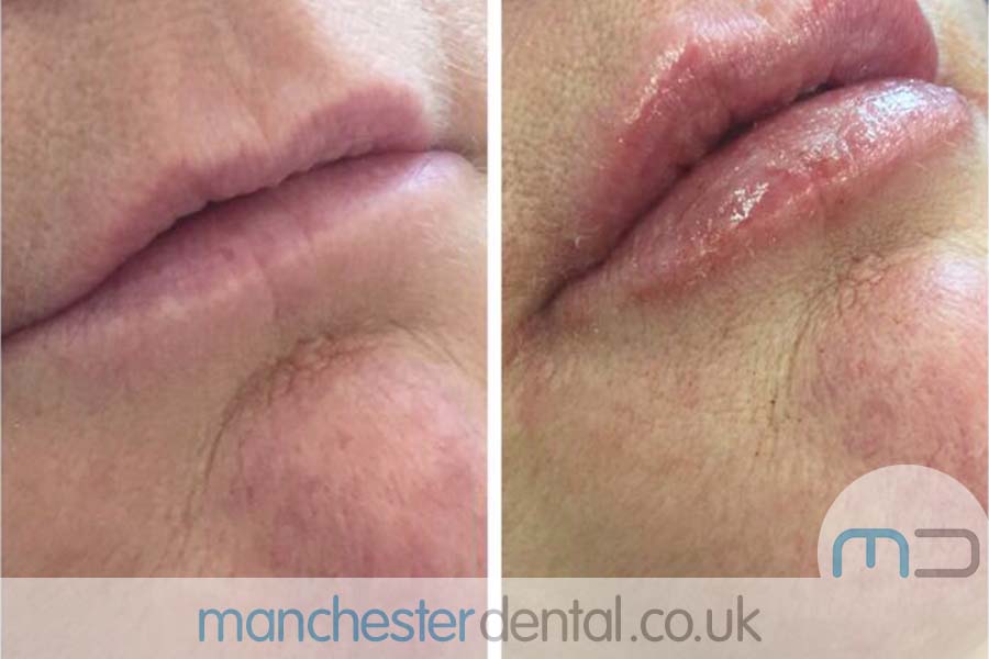 anti wrinkle treatment in manchester