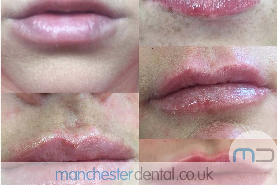 anti wrinkle treatment in manchester