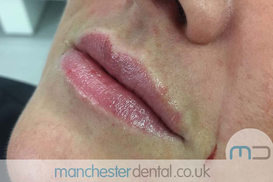 anti wrinkle treatment in manchester