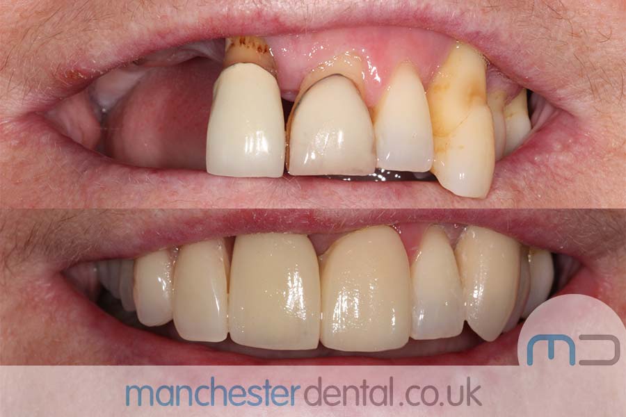 smile makeover manchester