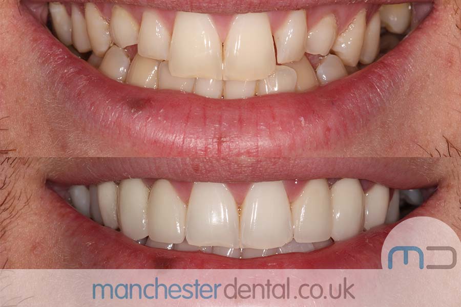 smile makeover manchester