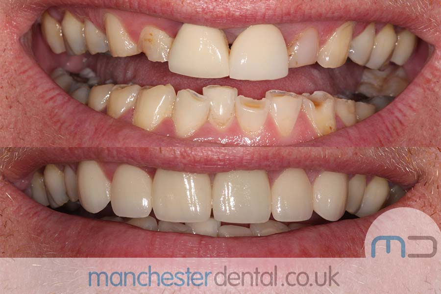 smile makeover manchester