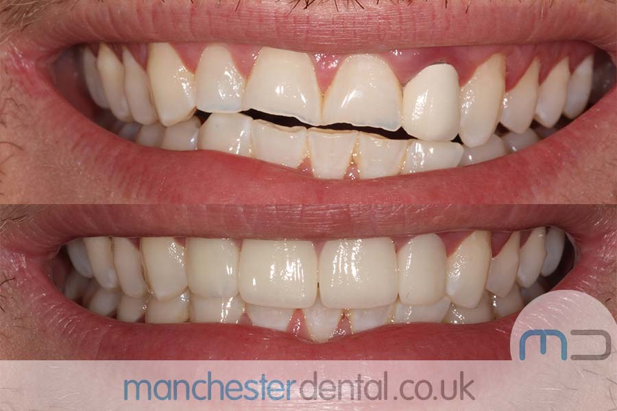 smile makeover manchester