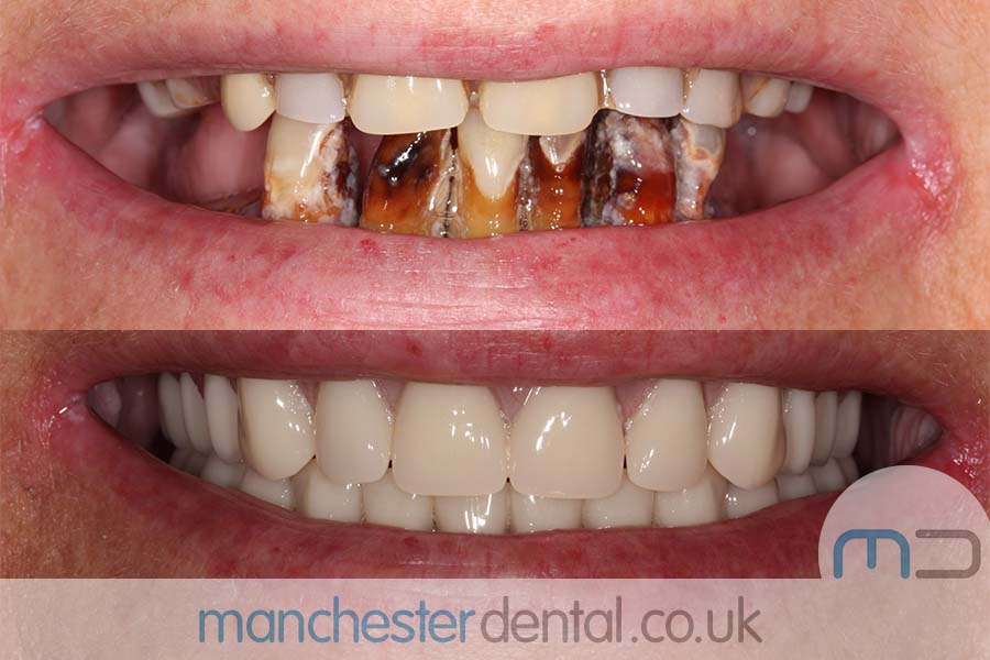 smile makeover manchester