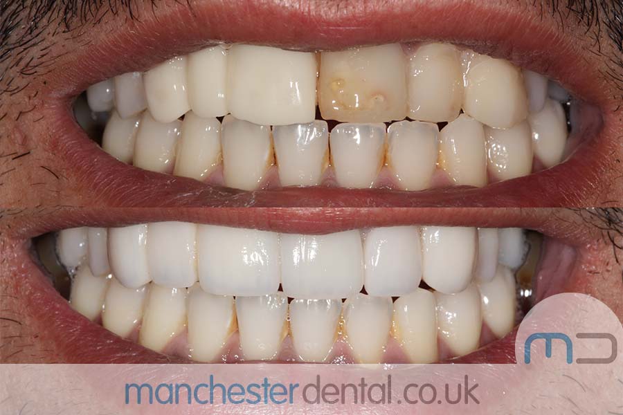 smile makeover manchester