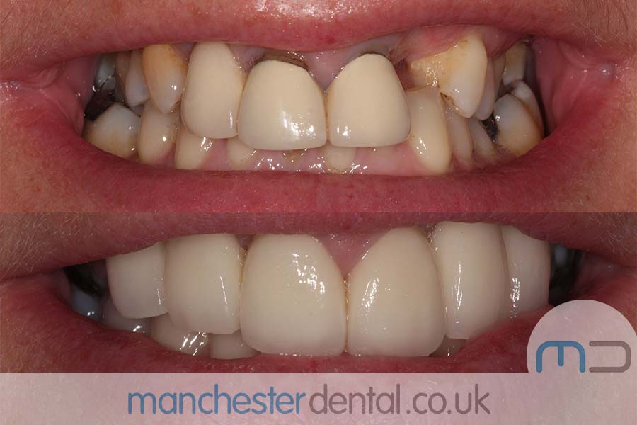 smile makeover manchester