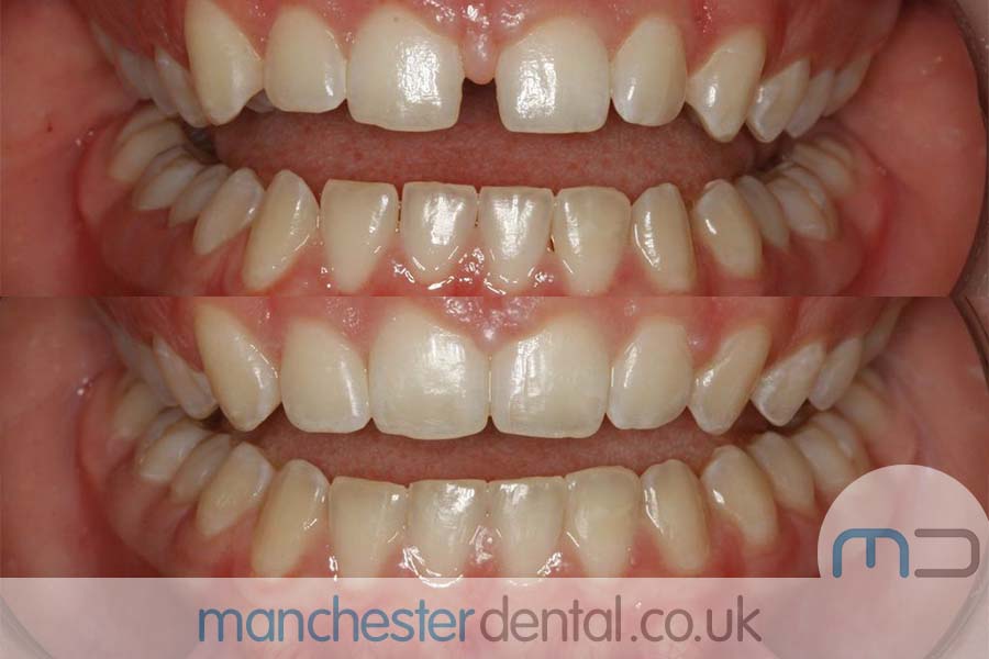 orthodontics manchester