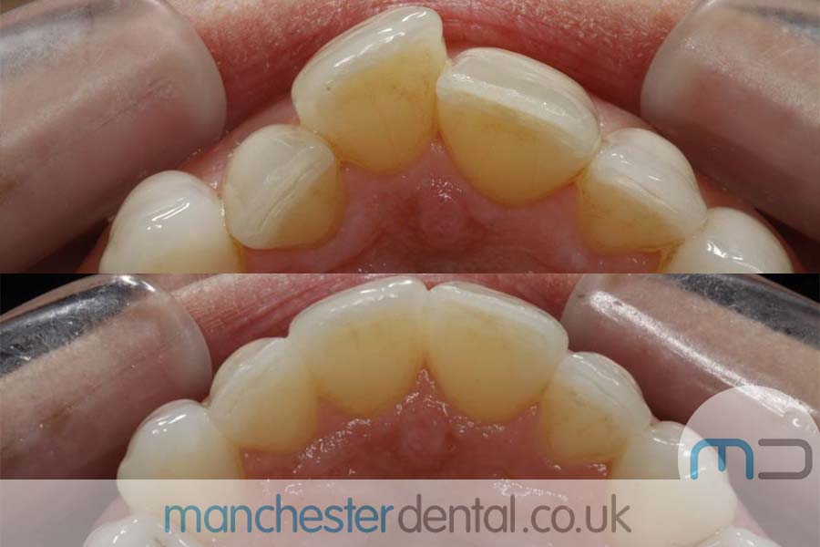 orthodontics manchester