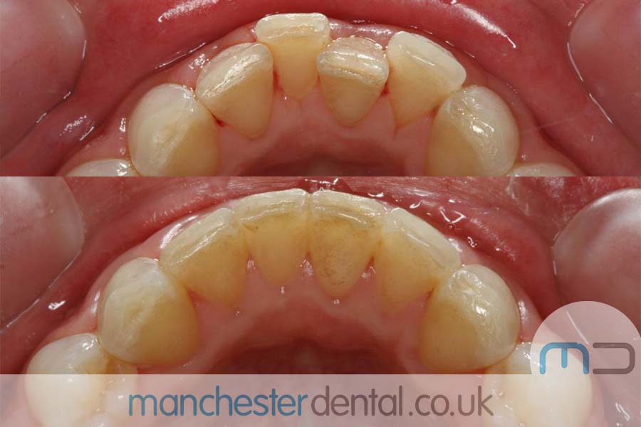 orthodontics manchester