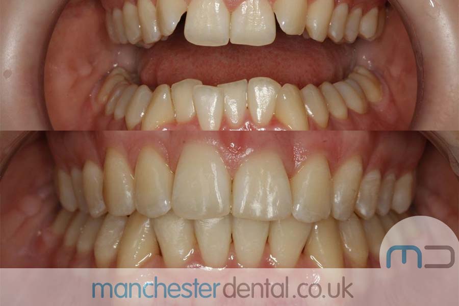 orthodontics manchester