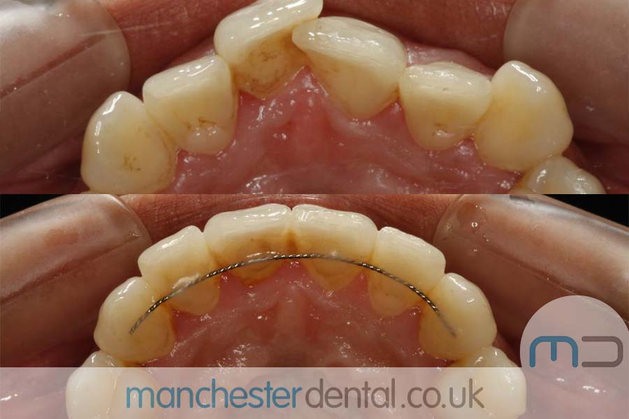 orthodontics manchester