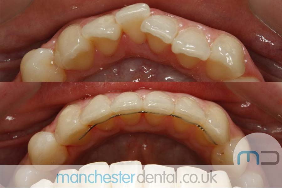 orthodontics manchester