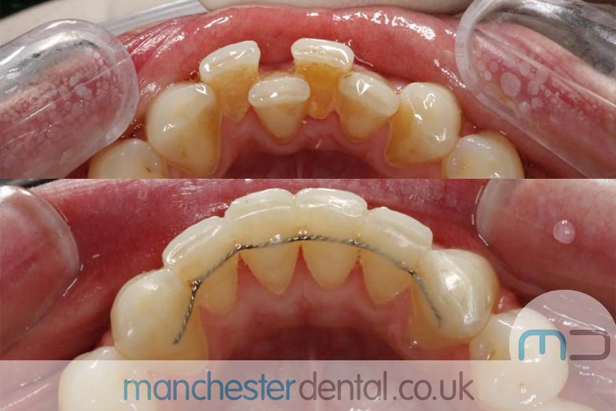orthodontics manchester