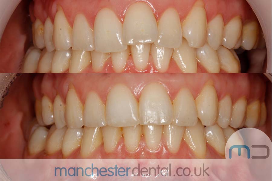 orthodontics manchester